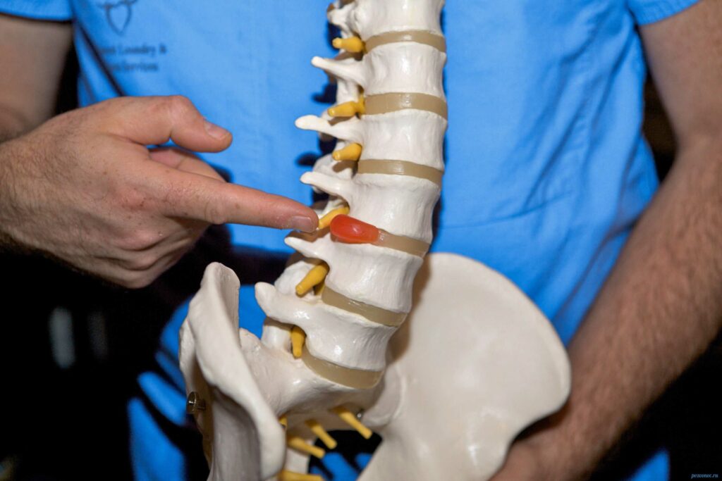 качественное лечение поясничной межпозвоночной грыжи